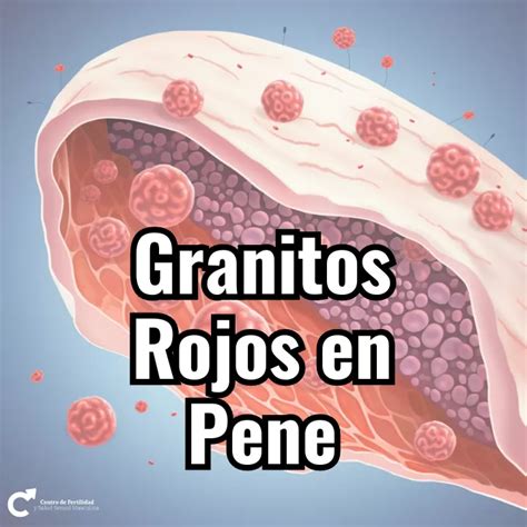 granos en la punta del pene|Enfermedades piel pene